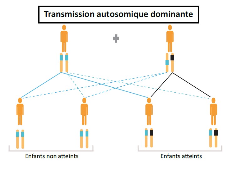 Transmission autosomique dominante