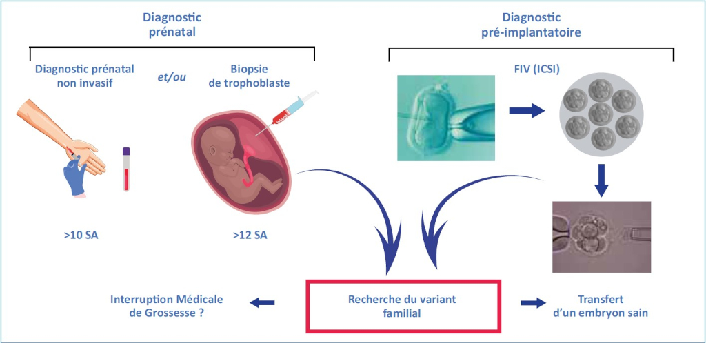 Figure 3 : Diagnostic prénatal et diagnostic préimplantatoire.